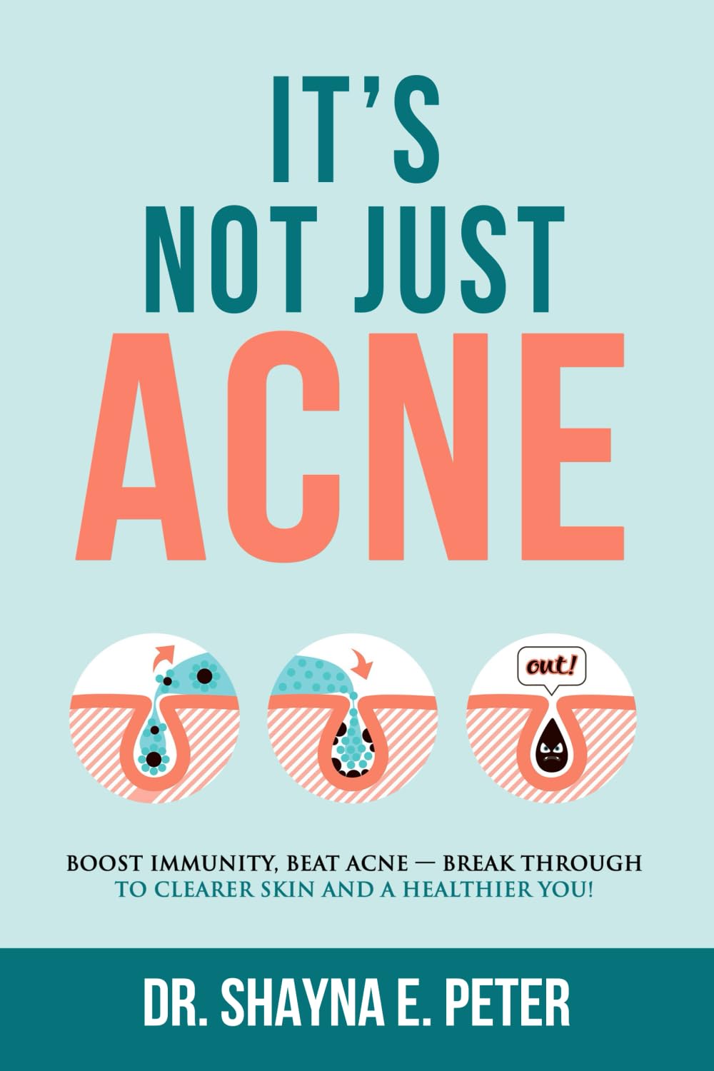 It’s Not Just Acne: Boost Immunity, Beat Acne – Break Through to Clearer Skin & A Healthier You! It’s Not Just Acne: Boost Immunity, Beat Acne – Break Through to Clearer Skin & A Healthier You!