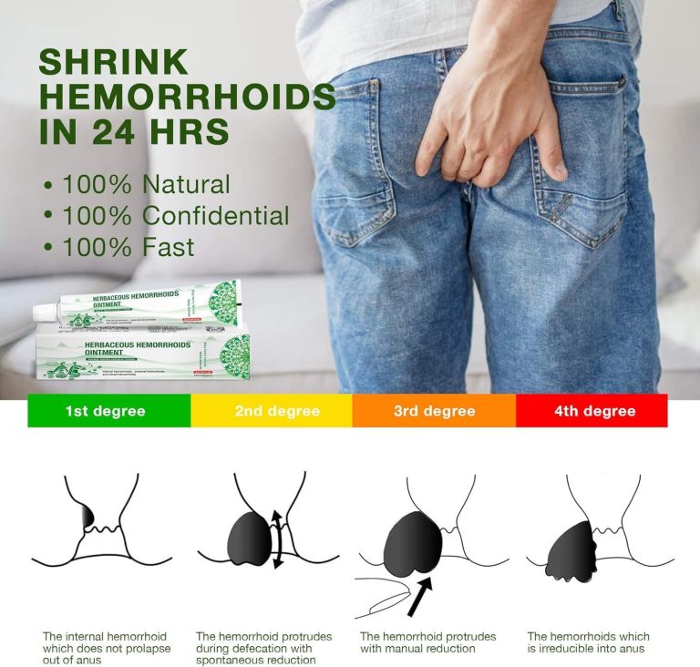 Hemorrhoid Cream: Advanced Herbal Hemorrhoids Treatment Cream for Itching and Burning, Shrink & Soothe Hemorrhoids – 1.8 Oz